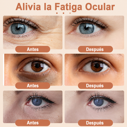 Masajeador de Ojos 3D Antiojeras
